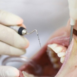 Periodontal Treatment