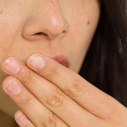 Cold Sore Treatment and Prevention Tips